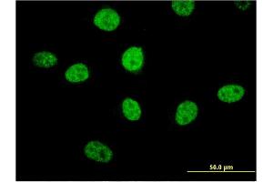 Immunofluorescence of monoclonal antibody to MIPOL1 on HeLa cell.