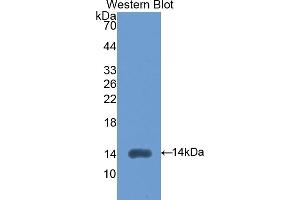 Western blot analysis of the recombinant protein. (LEFTY2 Antikörper  (AA 245-356))