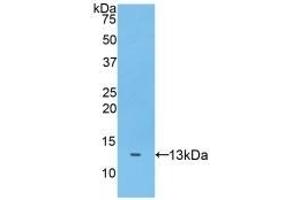 Detection of Recombinant ADAMTS7, Human using Polyclonal Antibody to A Disintegrin And Metalloproteinase With Thrombospondin 7 (ADAMTS7)