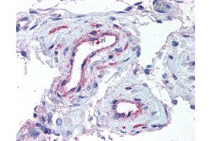 Immunohistochemistry (IHC) image for anti-ADAM Metallopeptidase with Thrombospondin Type 1 Motif, 1 (ADAMTS1) (N-Term) antibody (ABIN625843)