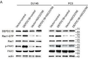 Inhibitor of active Rac1 (NSC23766) reverses the function in DEPDC1B-overexpressing cells.