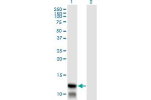 Western Blot analysis of TIMM8A expression in transfected 293T cell line by TIMM8A monoclonal antibody (M01), clone 2F11. (TIMM8A/DDP Antikörper  (AA 9-97))