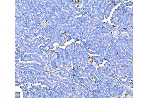 IHC analysis of Prothrombin using anti-Prothrombin antibody (ABIN7602705). (Prothrombin Fragment 2 (AA 97-124) Antikörper)