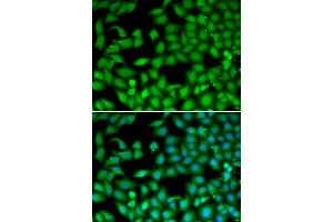 Immunofluorescence analysis of MCF-7 cells using RTKN antibody. (Rhotekin Antikörper)