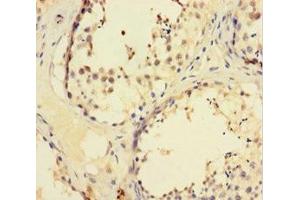 Immunohistochemistry of paraffin-embedded human testis tissue using ABIN7176122 at dilution of 1:100 (ZNF165 Antikörper  (AA 1-485))