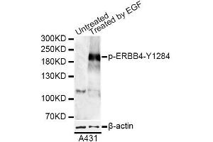 Western blot analysis of extracts of A-431 cells, using Phospho-ERBB4-Y1284 antibody (ABIN5969891) at 1/1000 dilution. (ERBB4 Antikörper  (pTyr1284))