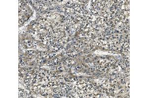 IHC analysis of eRF1/ETF1 using anti-eRF1/ETF1 antibody (ABIN7602626). (ETF1 Antikörper  (AA 9-342))