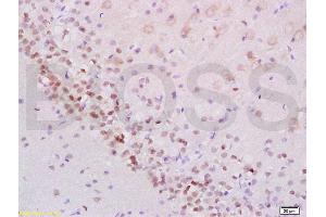 Formalin-fixed and paraffin embedded rat brain labeled with Anti-Phospho-Stat2 (Tyr690) Polyclonal Antibody, Unconjugated (ABIN746183) at 1:200 followed by conjugation to the secondary antibody and DAB staining (STAT2 Antikörper  (pTyr690))