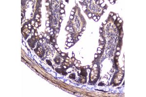 IHC analysis of 14-3-3 zeta/delta using anti-14-3-3 zeta/delta antibody . (14-3-3 zeta Antikörper)
