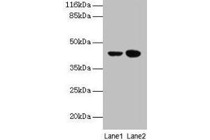 Western blot All lanes: CCR6 antibody at 10 μg/mL Lane 1: MCF-7 whole cell lysate Lane 2: Hela whole cell lysate Secondary Goat polyclonal to rabbit IgG at 1/10000 dilution Predicted band size: 43 kDa Observed band size: 43 kDa (CCR6 Antikörper  (AA 322-374))