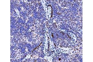 IHC analysis of Podoplanin/gp36/Pdpn using anti-Podoplanin/gp36/Pdpn antibody (ABIN7600811).