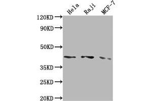 Western Blotting (WB) image for anti-Angiotensin II Receptor, Type 1 (AGTR1) antibody (ABIN7127327)