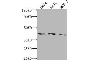 Western Blot Positive WB detected in: Hela whole cell lysate, Raji whole cell lysate, MCF-7 whole cell lysate All lanes: AGTR1 antibody at 1:2000 Secondary Goat polyclonal to rabbit IgG at 1/50000 dilution Predicted band size: 42 kDa Observed band size: 42 kDa (Rekombinanter Angiotensin II Type-1 Receptor Antikörper)
