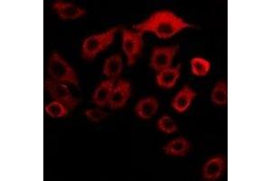 Immunofluorescent analysis of MBTPS1 staining in SKOV3 cells. (MBTPS1 Antikörper)