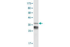Western Blot detection against Immunogen (37. (GLI3 Antikörper  (AA 1-110))