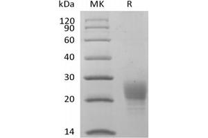 Poliovirus Receptor-Related Immunoglobulin Domain Containing (PVRIG) protein (His tag)