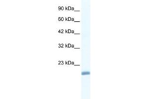 WB Suggested Anti-EDF1 Antibody Titration:  1. (EDF1 Antikörper  (N-Term))