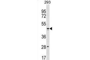 Western Blotting (WB) image for anti-Family with Sequence Similarity 155, Member B (FAM155B) antibody (ABIN3000232) (FAM155B Antikörper)