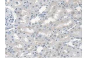 Detection of CES1 in Rat Kidney Tissue using Polyclonal Antibody to Carboxylesterase 1 (CES1) (CES1 Antikörper  (AA 19-300))