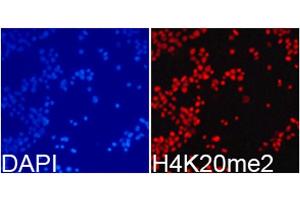 Immunofluorescence analysis of 293T cells using DiMethyl-Histone H4-K20 antibody. (Histone H4 Antikörper  (2meLys20))