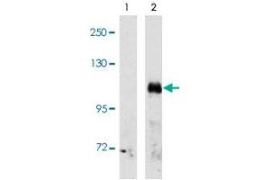 Western blot analysis of EPHA3 (arrow) using EPHA3 polyclonal antibody . (EPH Receptor A3 Antikörper  (C-Term))