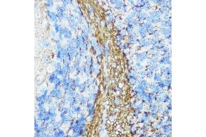 Immunohistochemistry of paraffin-embedded mouse brain using Neurofilament M Rabbit pAb (ABIN7268865) at dilution of 1:100 (40x lens). (NEFM Antikörper  (AA 200-300))