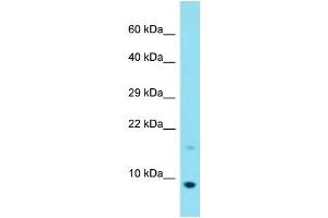 Host: Rabbit Target Name: C20orf166 Sample Type: MCF7 Whole Cell lysates Antibody Dilution: 1. (C20orf166 Antikörper  (C-Term))