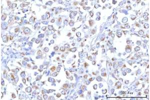 IHC analysis of PTPIP51/RMDN3 using anti-PTPIP51/RMDN3 antibody (ABIN7601775). (RMDN3 Antikörper  (AA 45-438))