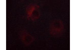ABIN6267378 staining RL cells by ICC/IF. (NCF1 Antikörper  (pSer359))