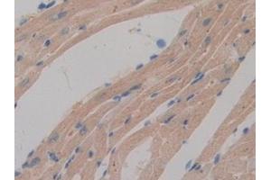 Immunohistochemistry (IHC) image for anti-Dual Adaptor of Phosphotyrosine and 3-phosphoinositides (DAPP1) (AA 1-280) antibody (ABIN7443326)