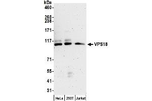 anti-Vacuolar Protein Sorting 18 Homolog (VPS18) (AA 900-950) antibody