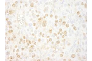 Immunohistochemistry (IHC) image for anti-BMI1 Polycomb Ring Finger Oncogene (BMI1) (AA 276-326) antibody (ABIN7448885)