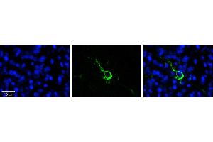 Rabbit Anti-LPIN1 Antibody  Catalog Number: ARP53826_P050  Formalin Fixed Paraffin Embedded Tissue: Human Pineal Tissue  Observed Staining: Cytoplasmic and membrane in cell bodies and processes of pinealocytes  Primary Antibody Concentration: 1:100  Other Working Concentrations: 1/600  Secondary Antibody: Donkey anti-Rabbit-Cy3  Secondary Antibody Concentration: 1:200  Magnification: 20X  Exposure Time: 0. (Lipin 1 Antikörper  (N-Term))