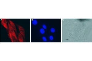 Expression of CNTF in rat C6 glioma cells - Immunocytochemical staining of fixed and permeabilized rat C6 glioma cells.
