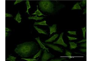 Immunofluorescence of monoclonal antibody to ISCU on HeLa cell. (ISCU Antikörper  (AA 26-167))