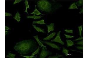 Immunofluorescence of monoclonal antibody to ISCU on HeLa cell. (ISCU Antikörper  (AA 26-167))