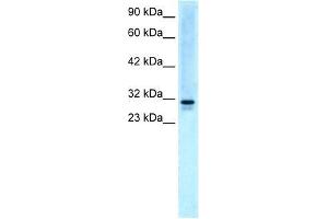 Human HepG2; WB Suggested Anti-EAP30 Antibody Titration: 5. (SNF8 Antikörper  (N-Term))