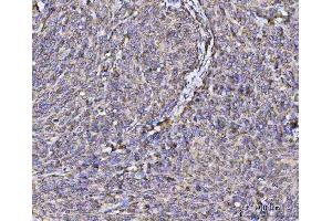 IHC analysis of RPL36 using anti-RPL36 antibody (ABIN7602917). (RPL36 Antikörper  (C-Term))
