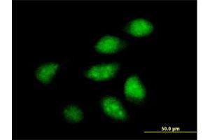 Immunofluorescence of purified MaxPab antibody to ARFIP2 on HeLa cell. (ARFIP2 Antikörper  (AA 1-341))