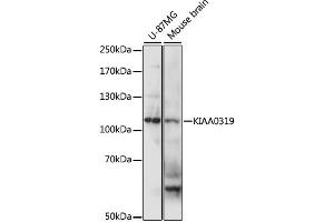 Western blot analysis of extracts of various cell lines, using KIAA0319 antibody (ABIN6290542) at 1:1000 dilution. (KIAA0319 Antikörper)