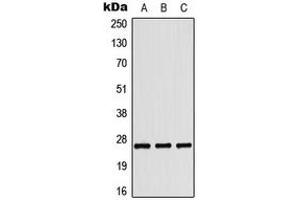 Western blot analysis of Tumstatin expression in HepG2 colchicine-treated (A), HeLa UV-treated (B), Raw264. (COL4a3 Antikörper  (C-Term))
