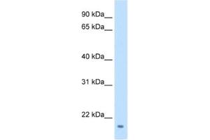 Western Blotting (WB) image for anti-Family with Sequence Similarity 107, Member A (FAM107A) antibody (ABIN2462571) (FAM107A Antikörper)
