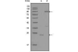 Western blot analysis using YES1 mouse mAb against truncated YES1-His recombinant protein (1) and full-length GFP-YES1(aa1-543) transfected COS7 cell lysate (2). (YES1 Antikörper  (AA 10-193))