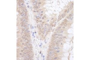 anti-ELL Associated Factor 2 (EAF2) (AA 150-200) antibody
