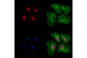 Phospho-EZH2 (Thr345) Antibody staining A549 cells(4h of LPS treatment) by IF/ICC.