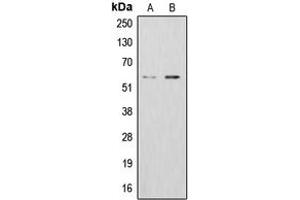 Western blot analysis of ALDH1B1 expression in K562 (A), HepG2 (B) whole cell lysates. (ALDH1B1 Antikörper  (Center))