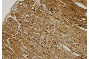 ABIN6274735 at 1/100 staining Mouse muscle tissue by IHC-P. (MRPL21 Antikörper  (Internal Region))