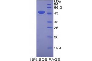 SDS-PAGE analysis of Mouse Laminin gamma 2 Protein. (LAMC2 Protein)