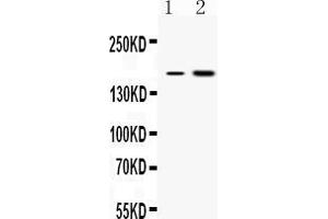 Western blot analysis of CSB expression in rat liver extract ( Lane 1) and COLO320 whole cell lysates ( Lane 2).