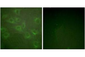 Immunofluorescence analysis of HuvEc cells, using Kv1. (KCNA3 Antikörper  (pTyr135))